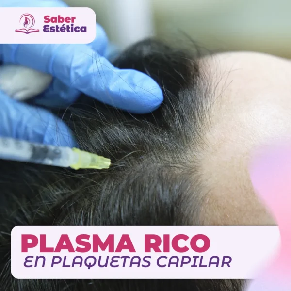 PLASMA RICO EN PLAQUETAS CAPILAR